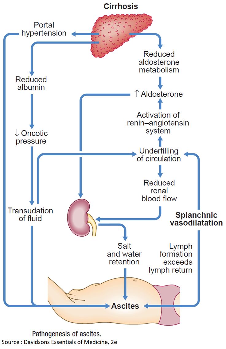 Pathophysiology diagram